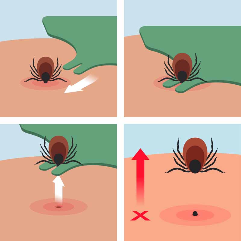 Zecken und Wandern – Borreliose und FSME – Wie kann man das Risiko von Zeckenstichen auf Wanderungen vermeiden und Erkrankungen vorbeugen?