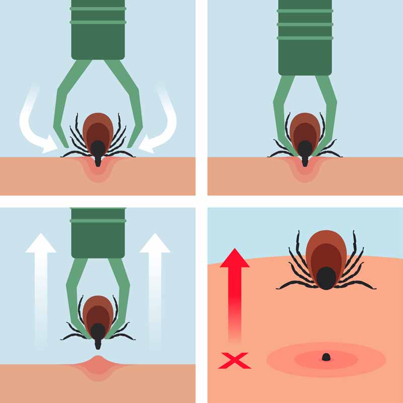 Zecken und Wandern – Borreliose und FSME – Wie kann man das Risiko von Zeckenstichen auf Wanderungen vermeiden und Erkrankungen vorbeugen?